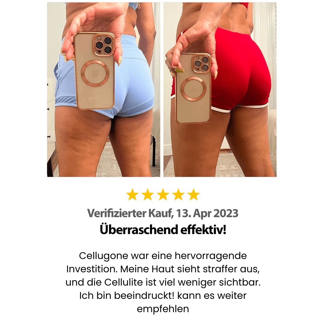Cellugone 3.0 - Glatte & straffe Haut in nur 14 Tagen